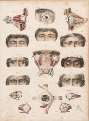 Allgemeines zur Operation schielender Augen