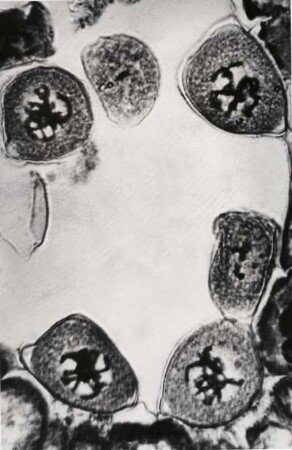 Chromosomen einer Lilie, ca. 1000-fach vergrößert, Mikrofotografie
