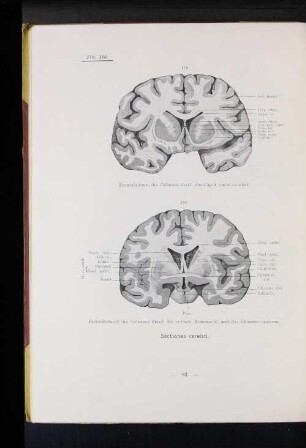 Sectiones cerebri.