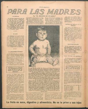 Contra las señales de la viruela