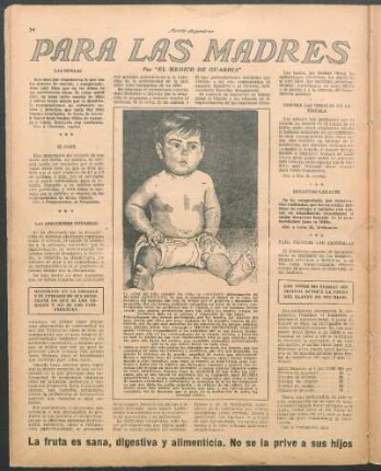 Contra las señales de la viruela
