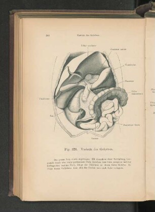 Fig. 328. Varietät des Gekröses.