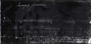 [Graphical recordings: respiration]