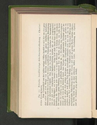 Fig. 71. Frische herdförmige Aderhautentzündung - Chorioditis disseminata.