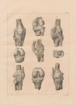 Anatomie des Kniegelenkes