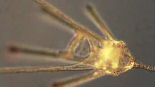 Echinocardium cordatum, medium pluteus 1.1 mm Helgoland 2013