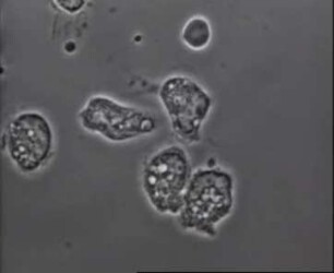 Leukozyten (Bos taurus) - Morphologische Veränderungen unter Einwirkung von Leukozidin aus Staphylococcus aureus in vitro