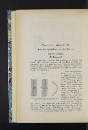 Sechster Abschnitt. Von den Operationen an den Nerven.