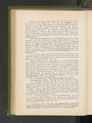 Fig. 2 Längsschnitt durch den normalen Sehnerveneintritt.