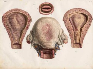 Der Uterus nach der Schwangerschaft