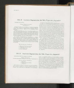 Abb. 20 Amyloide Degeneration der Milz, Typus der "Sagomilz"