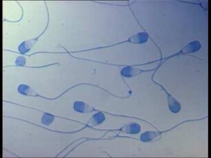 Artificial Insemination in Cattle - 2. Evaluating Semen