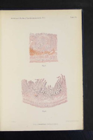 Jahrbücher d. Hamburg. Staatskrankenanstalten. VI. 2. Tafel VII.
