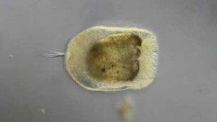 Anthozoa, planula larva Sylt 2015