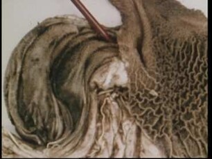 Motility of the Forestomach in Ruminants