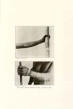 Plate CXLVII. Bontoc woman's tattoo (a) old; (b) new