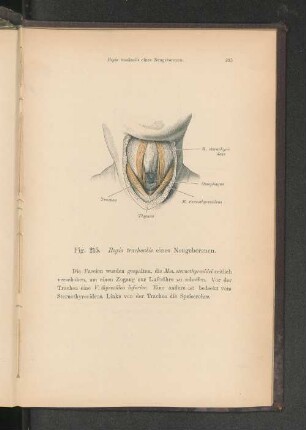Fig. 215. Regio trachealis eines Neugeborenen.