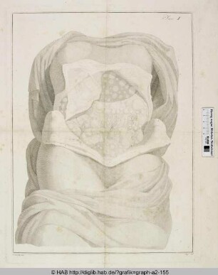 Anatomie des Menschen - Bauchöffnung.