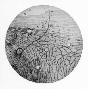 Blattepidermis von Mariopteris muricata (R. Potonié) : Geologie | Kohlengeologie | Das mikroskopische Bild der Kohle (Mikroskopische Kohlenpetrographie)