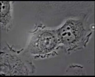 Portio-Carcinom in vitro - Stamm HeLa - Homo sapiens - Zellschädigung durch Gammastrahlen (Cobalt 60)