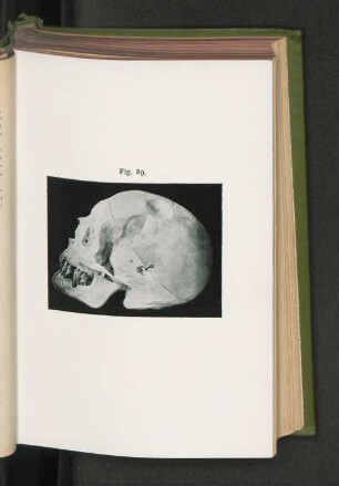Fig. 89.