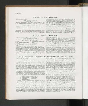 Ab. 35 Gesunde Nebenniere