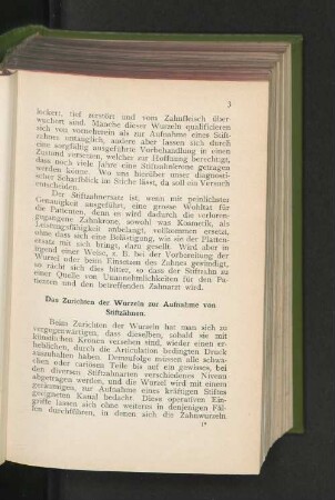 Das Zurichten der Wurzeln zur Aufnahme von Stiftzähnen.
