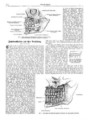 Zahnkrankheiten und ihre Verhütung