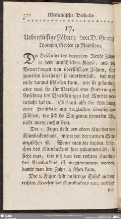 17. Ueberflüssige Zähne