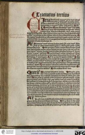 Argumentum: iste tractatus tertius deberet precedere primum ergo hoc ordo est malus...