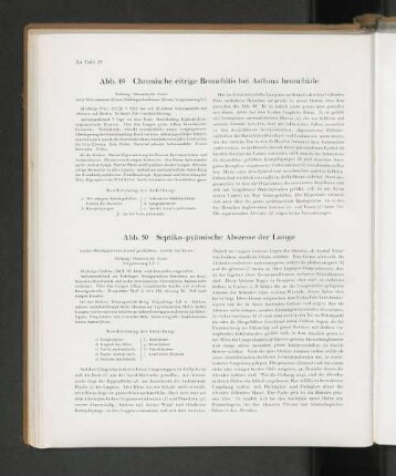 Abb. 49 Chronische citrige Bronchitis bei Asthma bronchiale