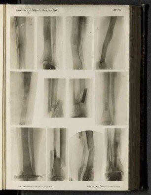 Tafel XII.