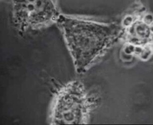 Vesicular-Stomatitis-Virus (Stamm Indiana) - Cytopathische Veränderungen in der Gewebekultur (HEp-2)