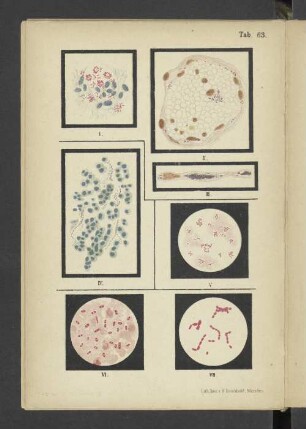 Tab. 63 Mycobacterium leprae. - Bacterium influenzae. - Bacterium pestis