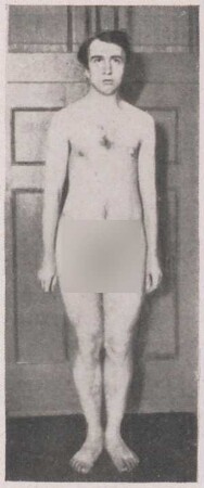 Fotografie einer unbekleideten Person vor einer Zimmertür stehend (2)