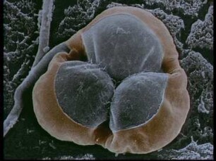 Trapping of Nematodes by Constricting Rings of Arthrobotrys dactyloides and Dactylaria brochopaga