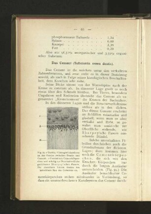 Das Cement (Substantia ossea dentis).