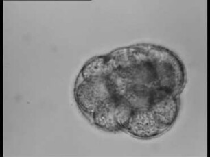 Rotaliella heterocaryotica (Foraminifera) - Nahrungsaufnahme, Teilung, Kammerbildung