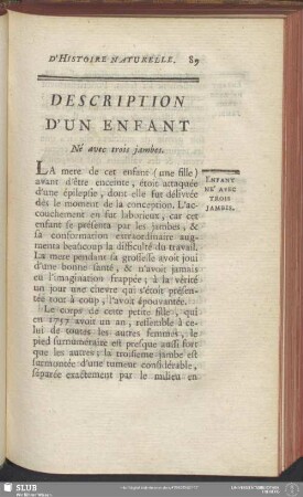 Description D'Un Enfant Né avec trois jambes