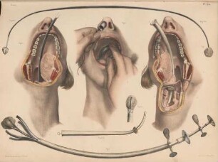 Die Einführung eines Katheters in Kehlkopf und Speiseröhre