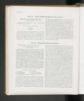 Abb. 54 Käsige Bronchopnemonien
