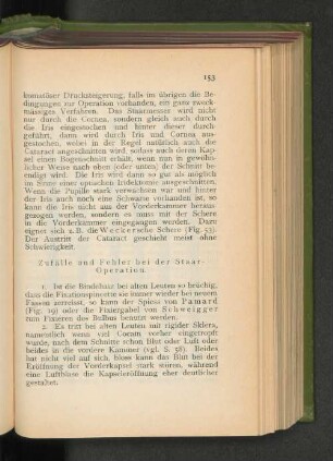 Zufälle und Fehler bei der Staar-Operation.