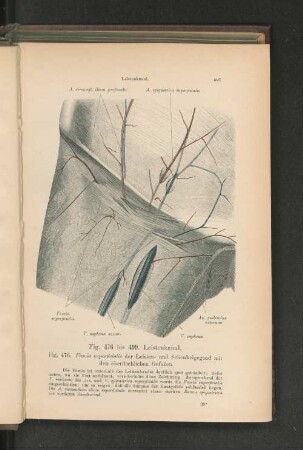 Fig. 476. Fascia superficialis der Leisten- und Schenkelgegend mit den oberflächlichen Gefäßen.