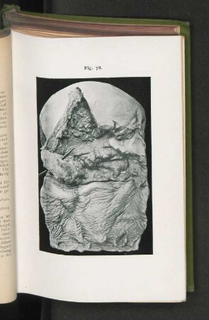 Fig. 78.