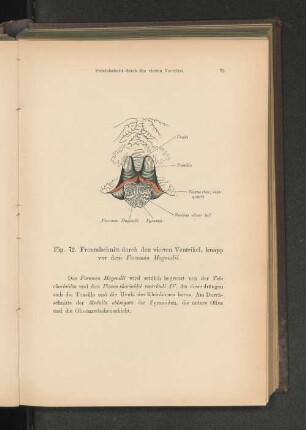 Fig. 72. Frontalschnitt durch den vierten Ventrikel, knapp vor dem Foramen Magendii.