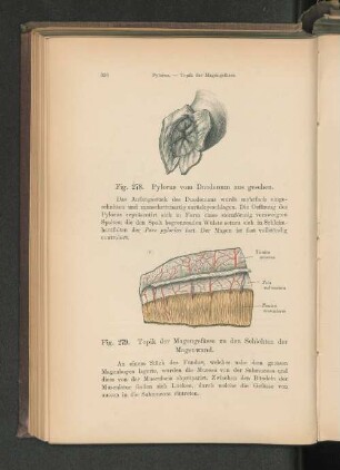 Fig. 279. Pylorus vom Duodenum aus gesehen.