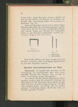 Fig. 37. Knochenklammer.