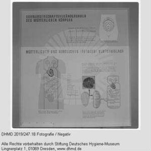 Nationale Hygiene-Ausstellung - Raum 14 - "Schwangerschaftsveränderungen des mütterlichen Körpers" und "Mütterlicher und kindlicher (fetaler) Blutkreislauf"