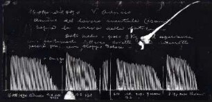 [Graphical recordings: fatigue]