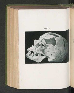 Fig. 140.